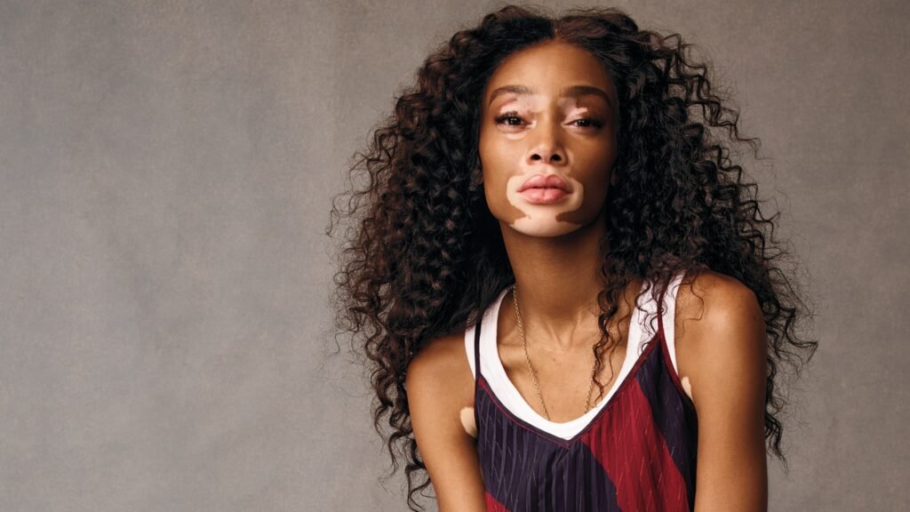 Winnie-Harlow-body-positive