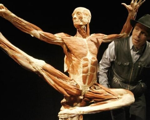 Gunther von Hagens