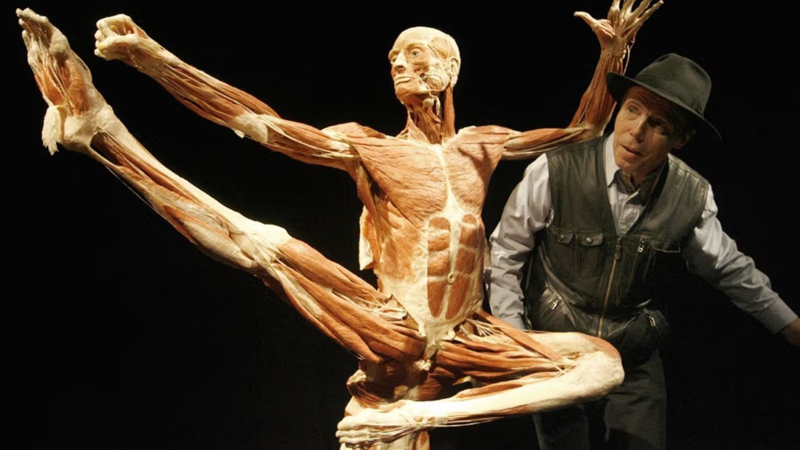 Gunther von Hagens